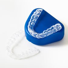 5 Practical Reasons Invisalign Fits the Lifestyle of Busy Toronto Adults