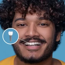 Why Choose a Local East York Dentist for Your Dental Implants?